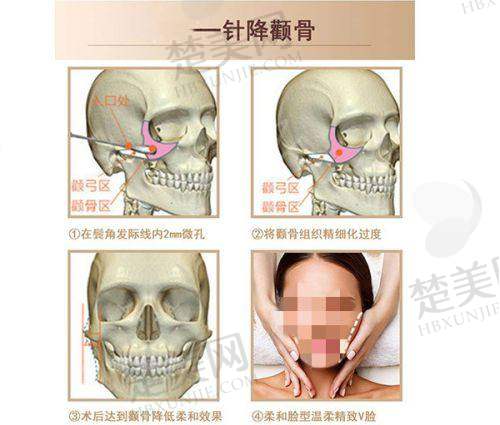 二、西安叶子医疗美容医院的优质设备与环境