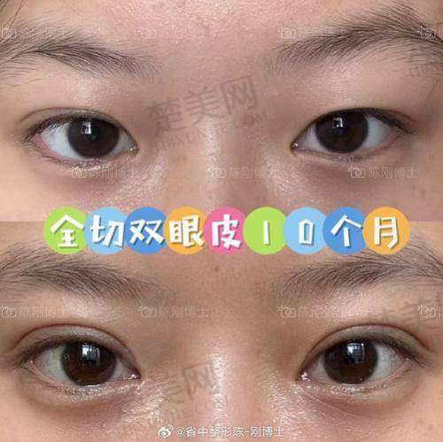 二、上海眼修复骨干医生杜园园预约渠道大公开