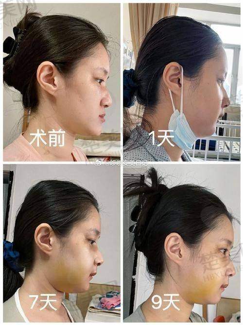 一、广州肖强医生简介