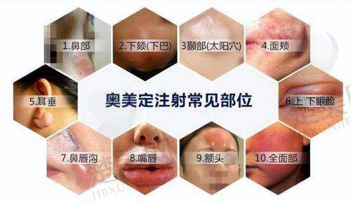 二、彭义坤医生隆胸技术特点
