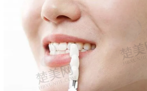 九、呼和浩特星耀口腔门诊部真实的患者评价