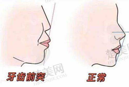 五、呼和浩特万诺口腔医生介绍