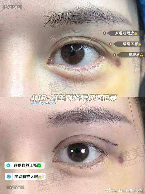 七、大连爱德丽格整形医院——宋立男
