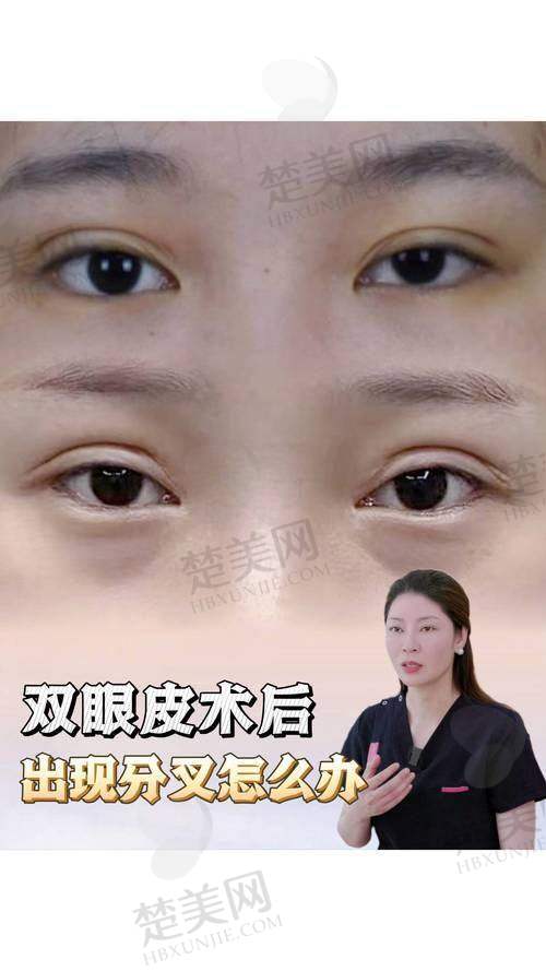 六、避坑提示