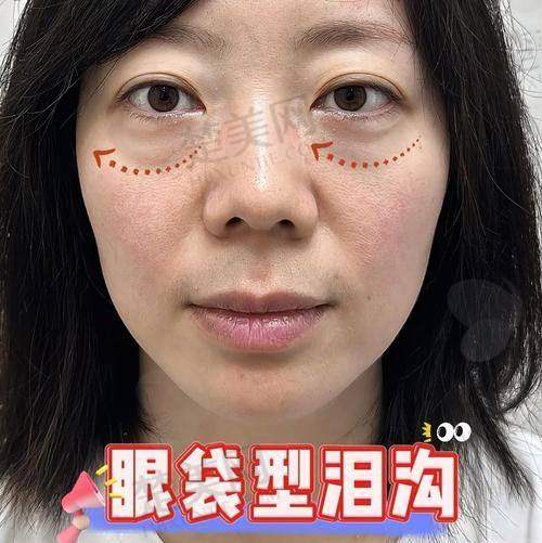 六、深圳市人民医院——孙辉医生