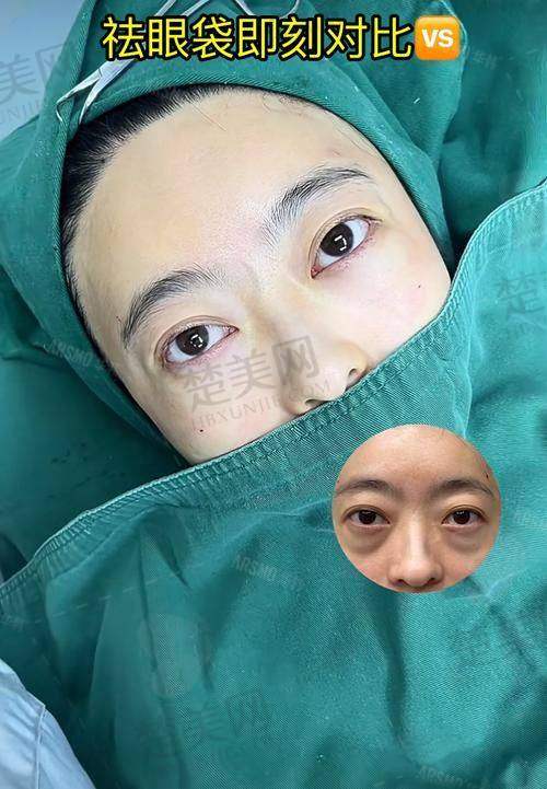 三、深圳非凡医疗美容医院——丁锋医生