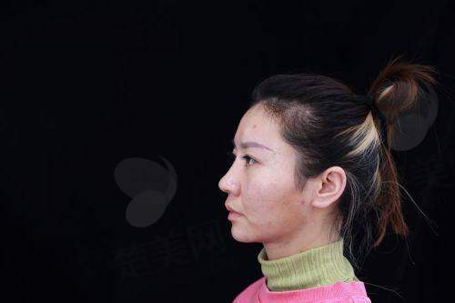 一、李信锋院长简介