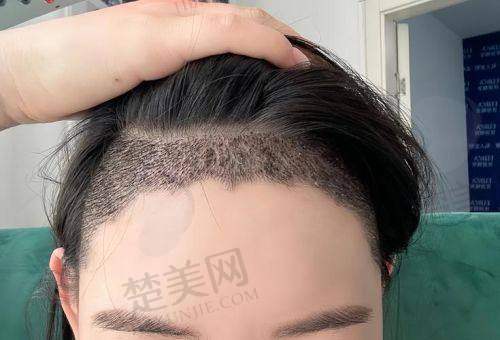 六、天津鑫伊颂整形美容诊所：本土新秀的贴心植发服务