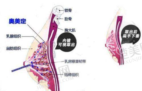 七、殷初阳医生 - 上海伯思立医疗美容