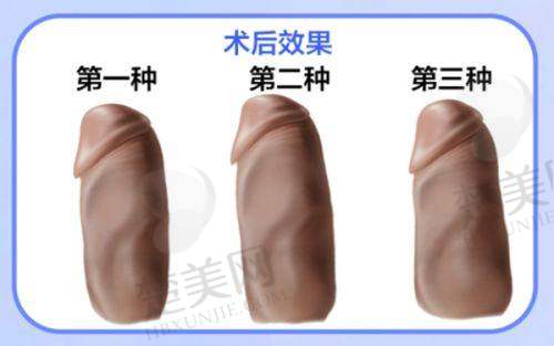 四、邹进进医生擅长技术及技术优势