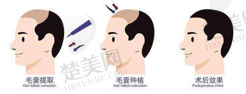 三、深圳米兰柏羽医疗美容——高品质服务之选