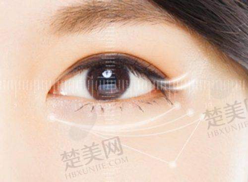 三、如何选择适合自己的去眼袋医院