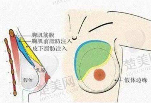 二、周口汇美医疗美容诊所：正规有保护，院长技术牛
