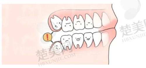 三、深圳正恩口腔门诊部诊疗项目有哪些？