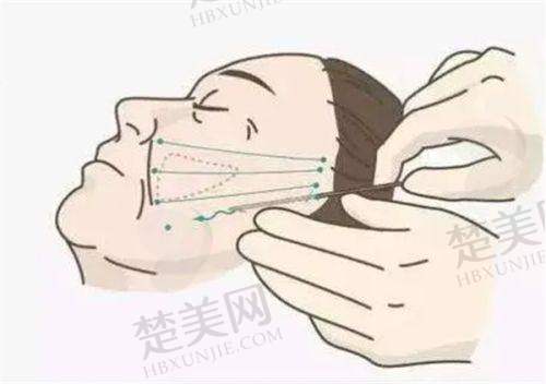 七、深圳宝丽医疗美容门诊部地址及交通