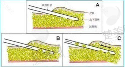 九、深圳宝丽医疗美容门诊部真实的患者评价