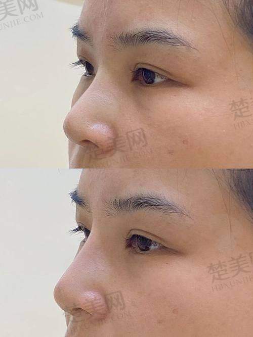五、患者评价与口碑