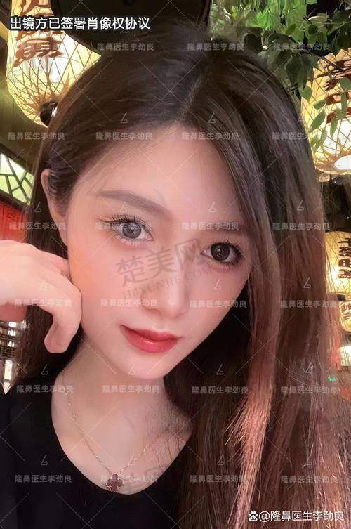 六、价格与性价比