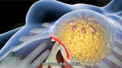 一、宋新医生简介