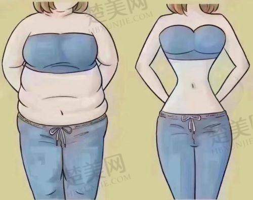五、亲历者分享深圳美加美大腿吸脂经历