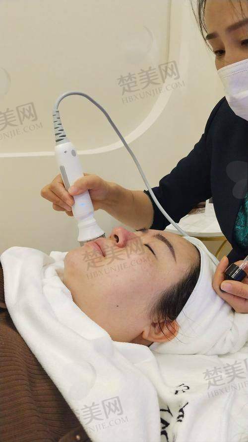 四、吉大一院整形科擅长项目——疤痕修复原理揭秘