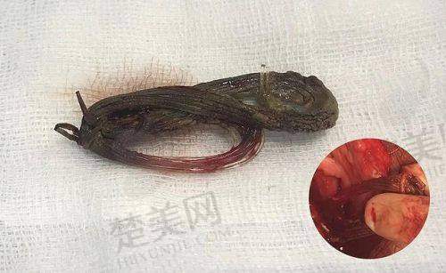 四、周云超医生异物取出的疗效评价