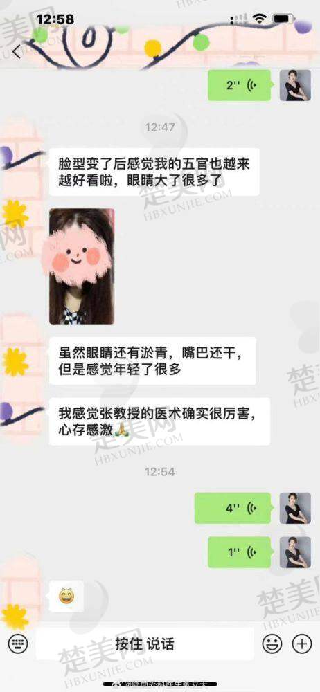三、何晋龙医生下颌角磨骨价格揭秘