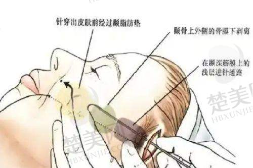 八、衡水唯美医疗美容门诊部预约方式