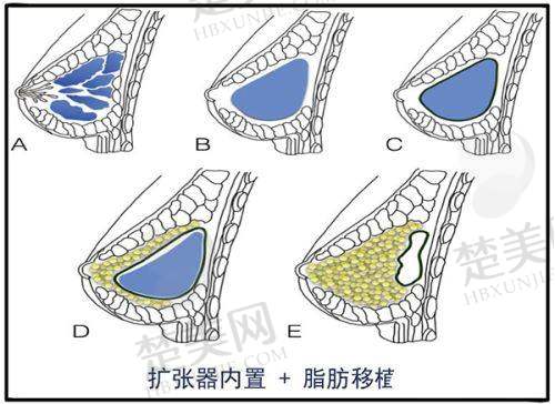 四、广西地区热门整形项目价格表