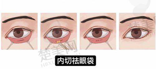 八、排名第七：武汉江城王松山医生