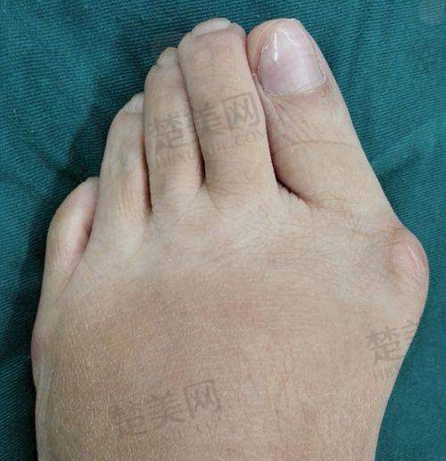 四、周泉医生：微整与皮肤光电的美丽魔法师