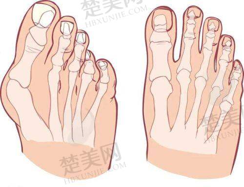 五、深圳李高峰医生在行业内的地位