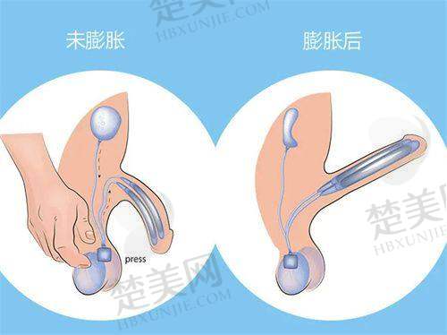 五、宁夏慧清雅妍医疗美容门诊部：眼鼻部精细化雕刻的特色之选