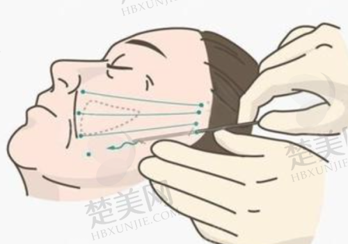 （三）NO.3 桂林医学校附属医院整形美容外科
