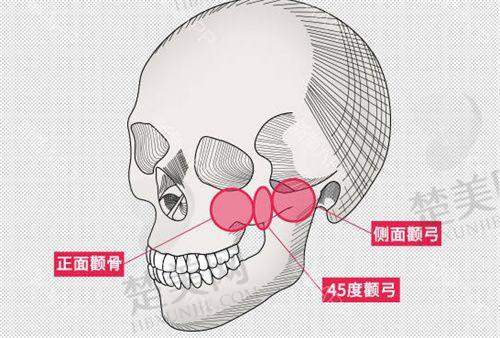 总结
