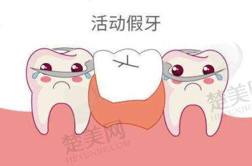 七、上海口腔种植价格表参考