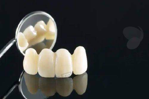 三、海宁安圣凯口腔——排名第三，科技派精细种植