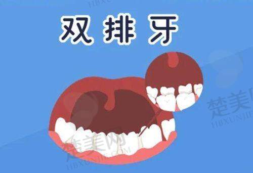 五、海宁市人民医院口腔科怎么样