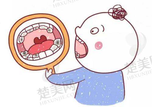 一、重庆观音桥15家牙科诊所核心项目收费PK