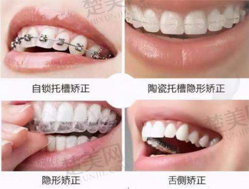 三、合肥壹加壹口腔开学季优惠价格表