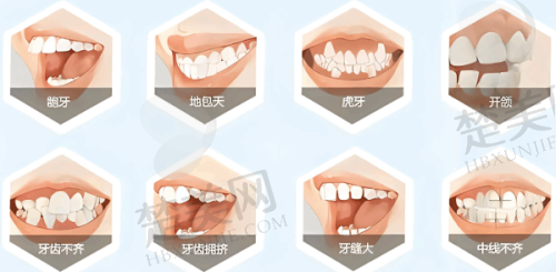 石家庄曼迪口腔价格表2025上新,种植牙2100元起多项口腔服务价优可选