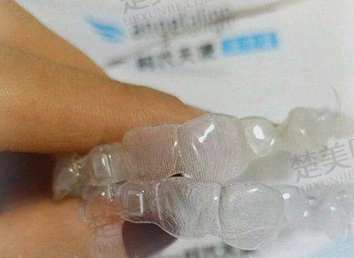 三、台州镶牙不同材料价格明细