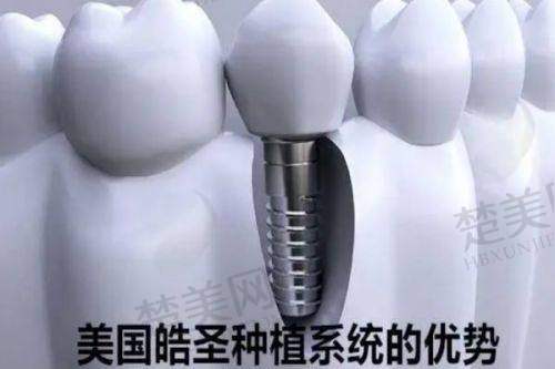 四、天津蓟州京医口腔医院的收费标准