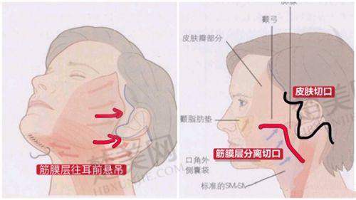 五、武汉同济医院整形科地址预约挂号