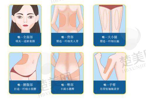 广州天姿医学美容医院祛痘科普