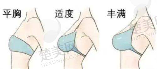 四、术后护理的重要性