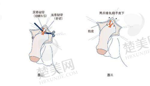 一、宁夏华美整形美容医院：西北地区的医美大腕