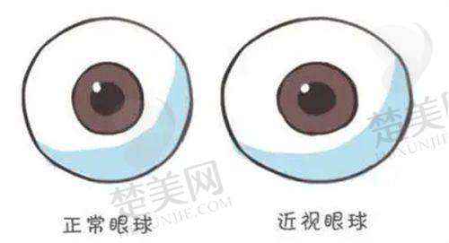 三、沧州爱尔眼科医院诊疗项目有哪些？