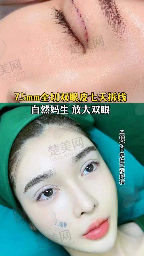 三、林靖医生的患者评价与口碑