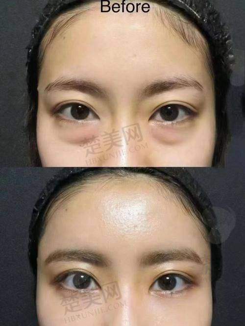 一、杭州韩美整形医院：专精与舒适并存